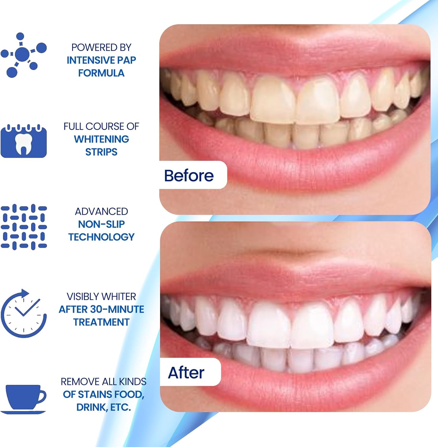 Teeth Whitening Strips- Mint Flavor, Zero Sensitivity, Enamel Safe, Dentist Formulated,Teeth Whitener Strips, White Teeth, Tooth Whitening Strip, Smile Teeth Whitening (Coconut)
